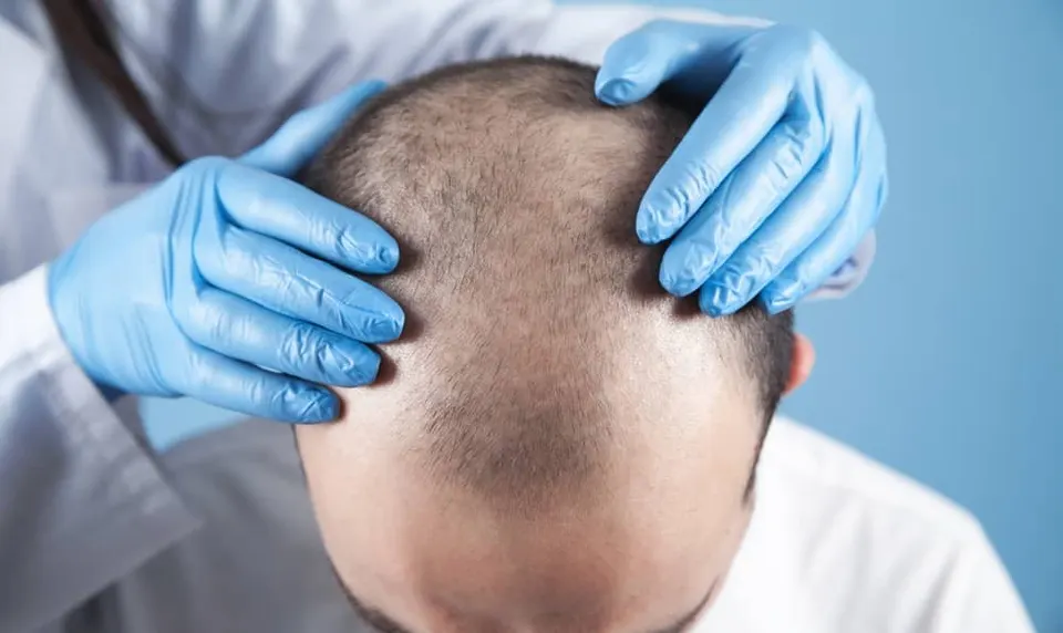 عيادة زراعة وترميم الشعر — عيادات 101 التجمع الخامس