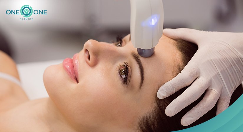 4 Facts You Need to Know About Fractional Laser